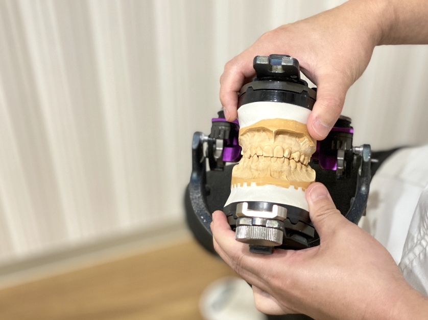 SAM咬合器 AXO アキシオグラフ、マウンティングジグ歯科矯正